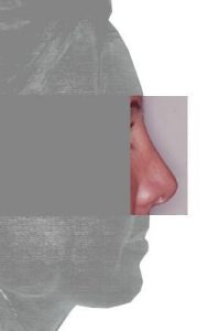 Dopo