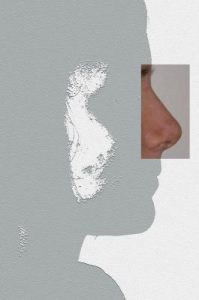 Dopo