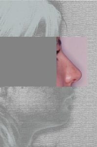 Dopo