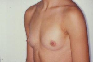 Prima