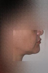 Prima