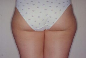 Prima