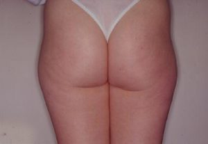 Prima