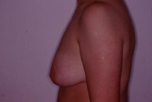Prima
